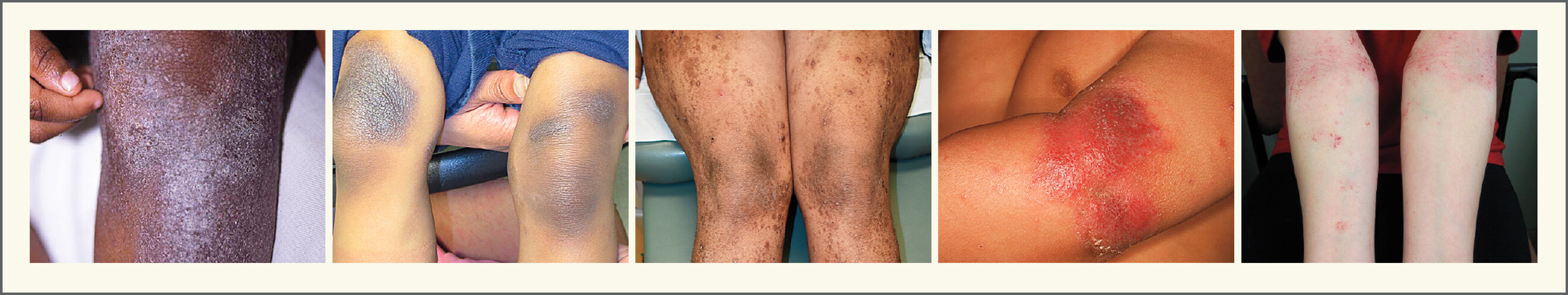 Our work has been highlighted in the New England Journal of Medicine!
