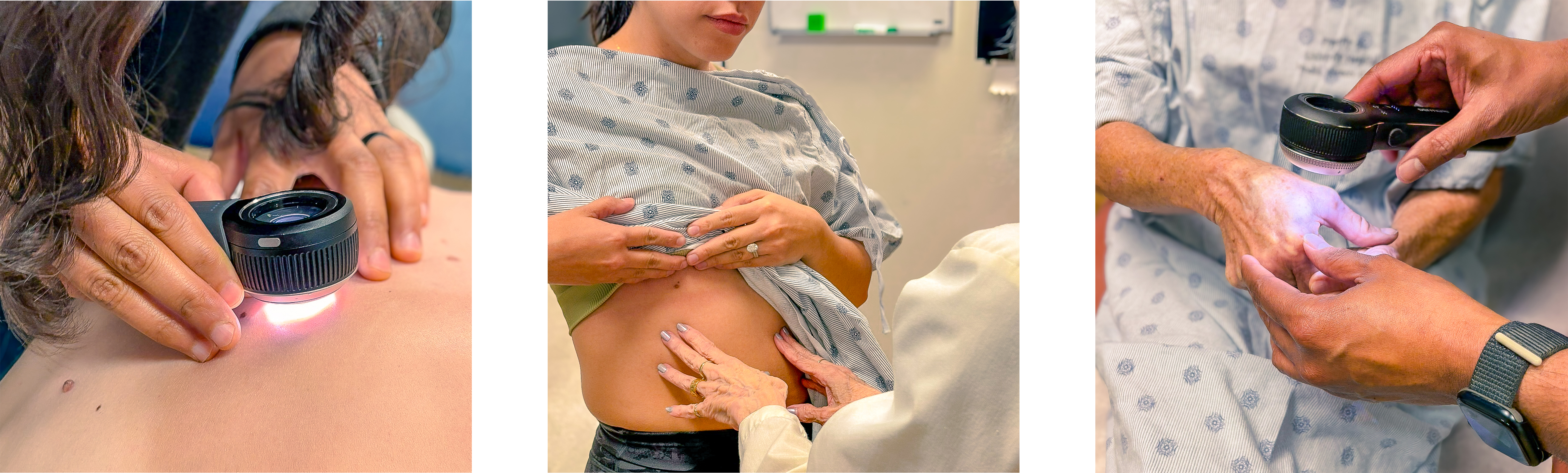 Albuquerque & Rio Rancho Free Skin Cancer Screenings 2025