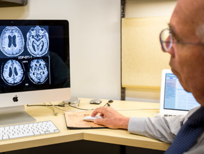 doctor looking at brain scan images on a computer