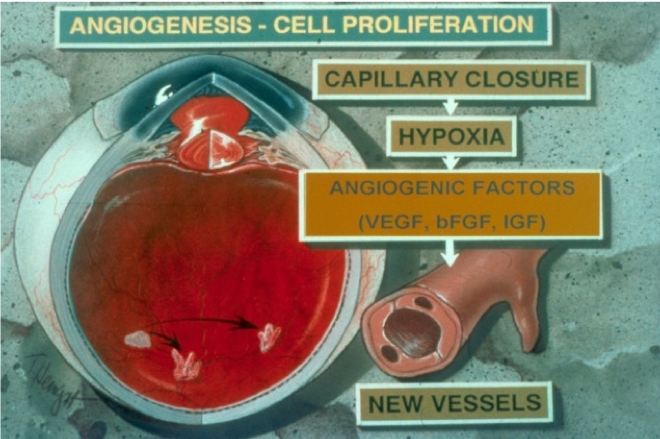 angiogenesis