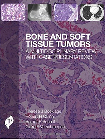 Tumeurs des os et des tissus mous : une revue multidisciplinaire avec présentations de cas