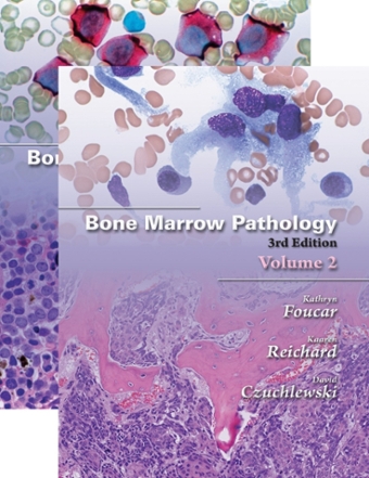 Patología de la médula ósea: ASCP Integrative Hematopatology Series 3