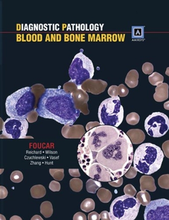 Patología diagnóstica: sangre y médula ósea