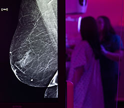 Imagen de mamografía
