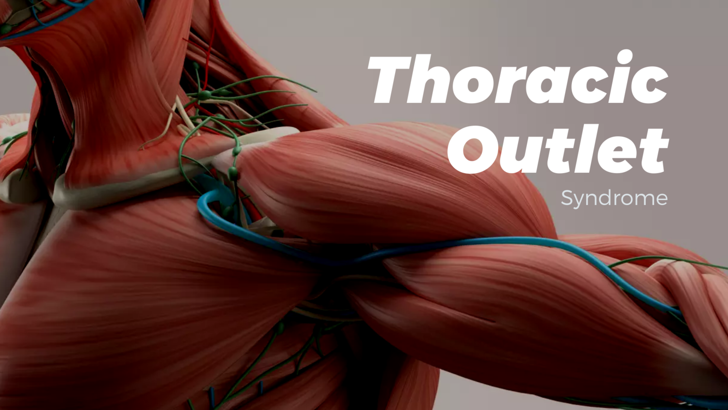 Thoracic Outlet