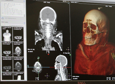 Scans of skull.