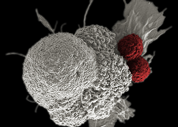 Células T atacando uma célula cancerosa.